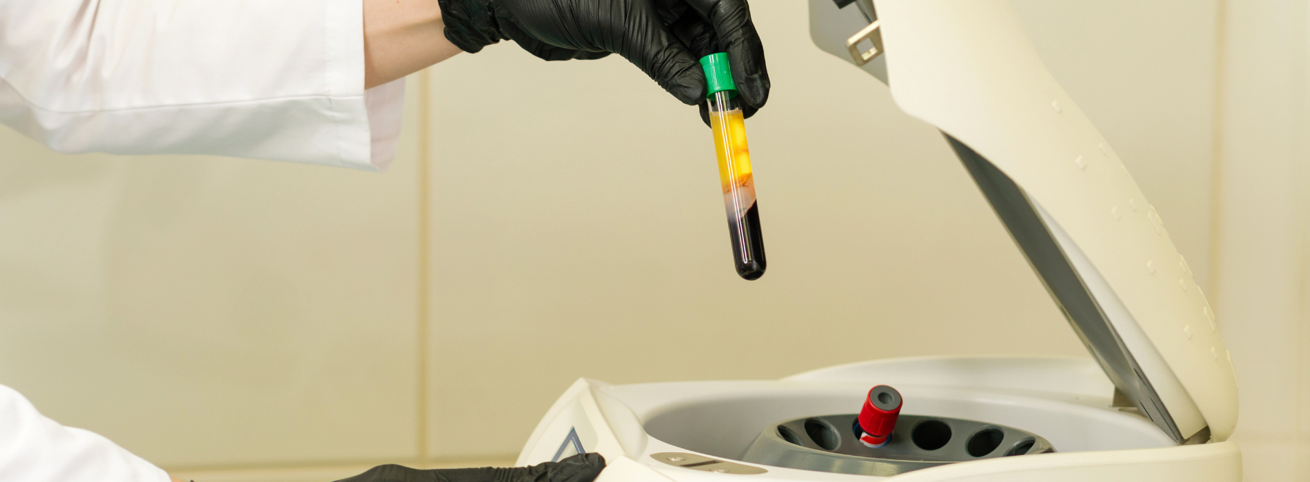 PRP therapy at Ringwood Sports medicine
